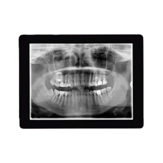 Digital x-rays